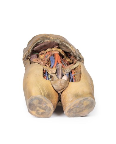 Dissezione dell addome con ernie bilaterali Erler Zimmer 3D anatomy Serie Dissezione dell addome con ernie bilaterali Erler Zimmer 3D anatomy Serie