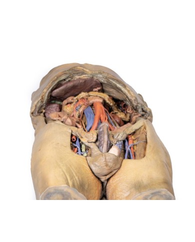 Dissezione dell addome con ernie bilaterali Erler Zimmer 3D anatomy Serie