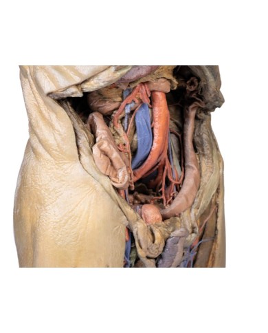 Dissezione dell addome con ernie bilaterali Erler Zimmer 3D anatomy Serie