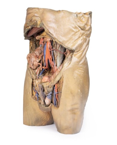 Dissezione dell addome con ernie bilaterali Erler Zimmer 3D anatomy Serie