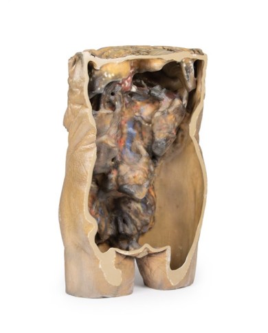 Dissezione dell addome con ernie bilaterali Erler Zimmer 3D anatomy Serie