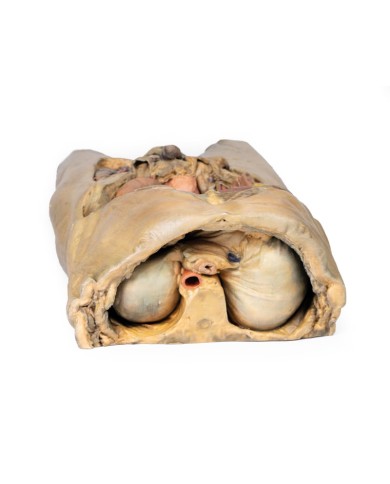 Dissezione dell addome con ernie bilaterali Erler Zimmer 3D anatomy Serie