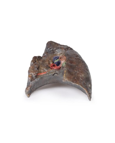 Dissezione dell ilo del polmone destro Erler Zimmer 3D anatomy Series MP1