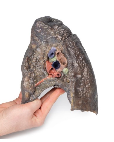 Dissezione dell ilo del polmone destro Erler Zimmer 3D anatomy Series MP1