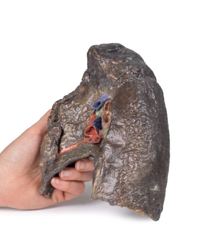 Dissezione dell ilo del polmone destro Erler Zimmer 3D anatomy Series MP1