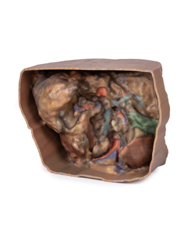 Vascolarizzazione addominale Erler Zimmer 3D anatomy Series MP1131