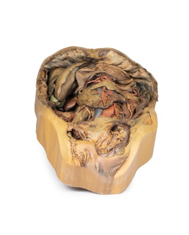 Dissezione dell addome con ernia inguinale Erler Zimmer 3D anatomy Series Dissezione dell addome con ernia inguinale Erler Zimmer 3D anatomy Series