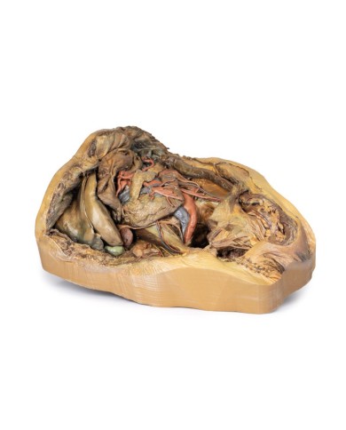 Dissezione dell addome con ernia inguinale Erler Zimmer 3D anatomy Series