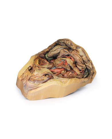 Dissezione dell addome con ernia inguinale Erler Zimmer 3D anatomy Series