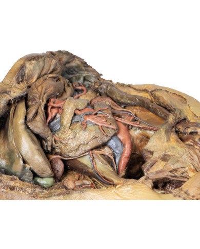 Dissezione dell addome con ernia inguinale Erler Zimmer 3D anatomy Series