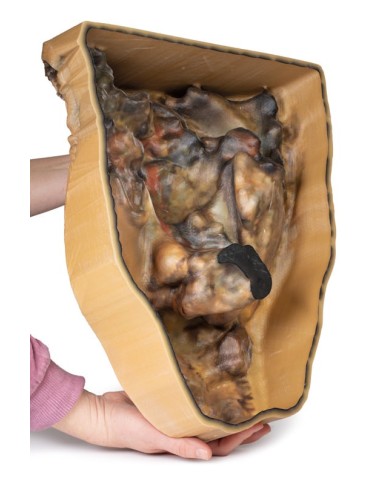 Dissezione dell addome con ernia inguinale Erler Zimmer 3D anatomy Series