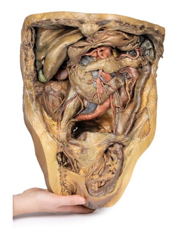 Dissezione dell addome con ernia inguinale Erler Zimmer 3D anatomy Series