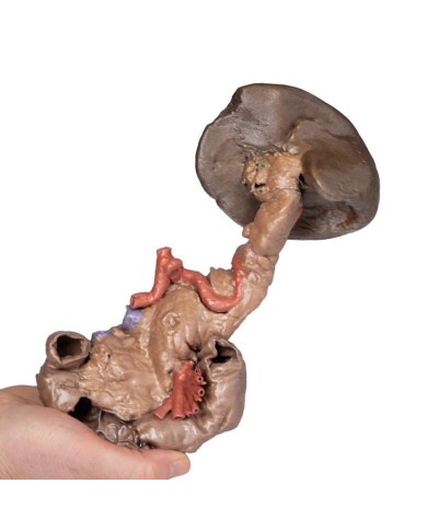 Dissezione di Milza e pancreas Erler Zimmer 3D anatomy Series MP1135