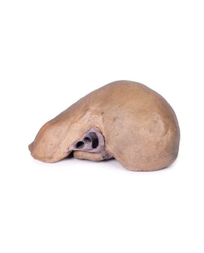 Fegato con vasi e cistifellea Erler Zimmer 3D anatomy Series MP1136