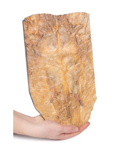 Parete addominale interna Erler Zimmer 3D anatomy Series MP1137 Parete addominale interna Erler Zimmer 3D anatomy Series MP1137