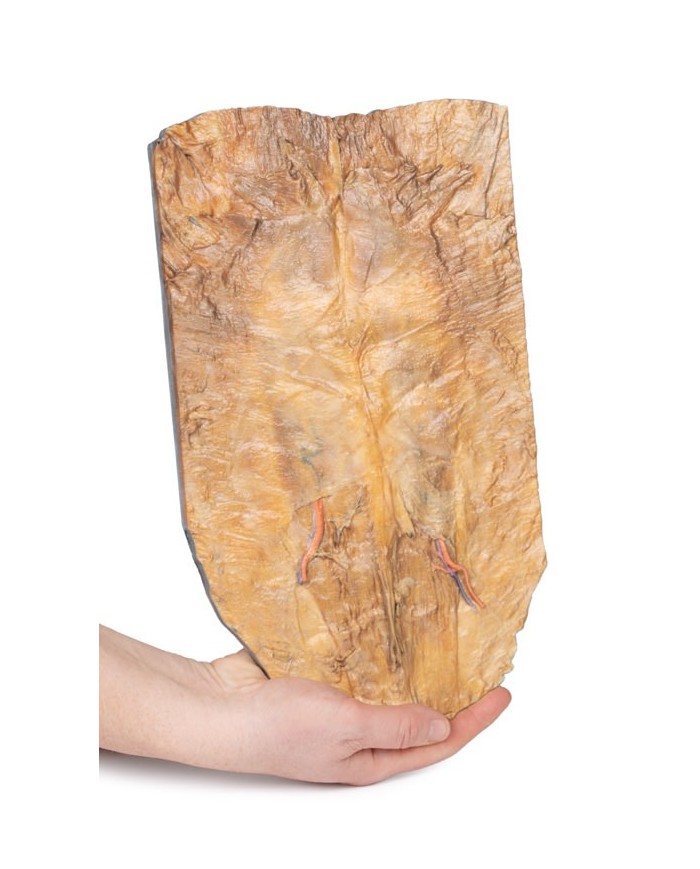 Parete addominale interna Erler Zimmer 3D anatomy Series MP1137