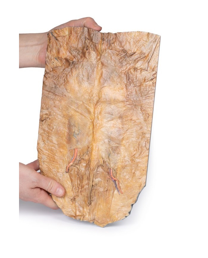 Parete addominale interna Erler Zimmer 3D anatomy Series MP1137