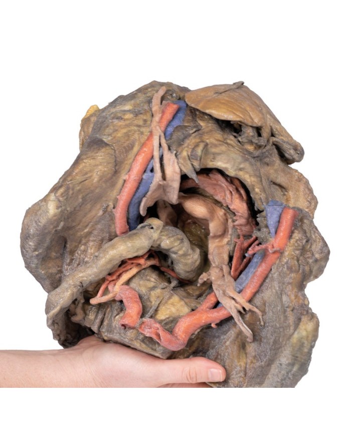 Dissezione profonda del bacino femminile Erler Zimmer 3D anatomy Series M