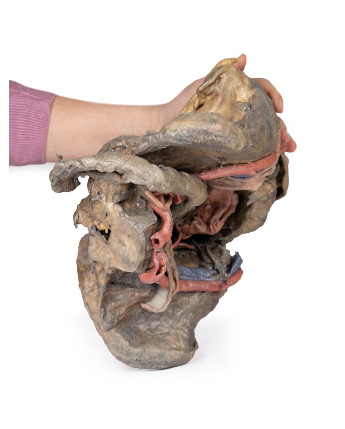 Dissezione profonda del bacino femminile Erler Zimmer 3D anatomy Series M