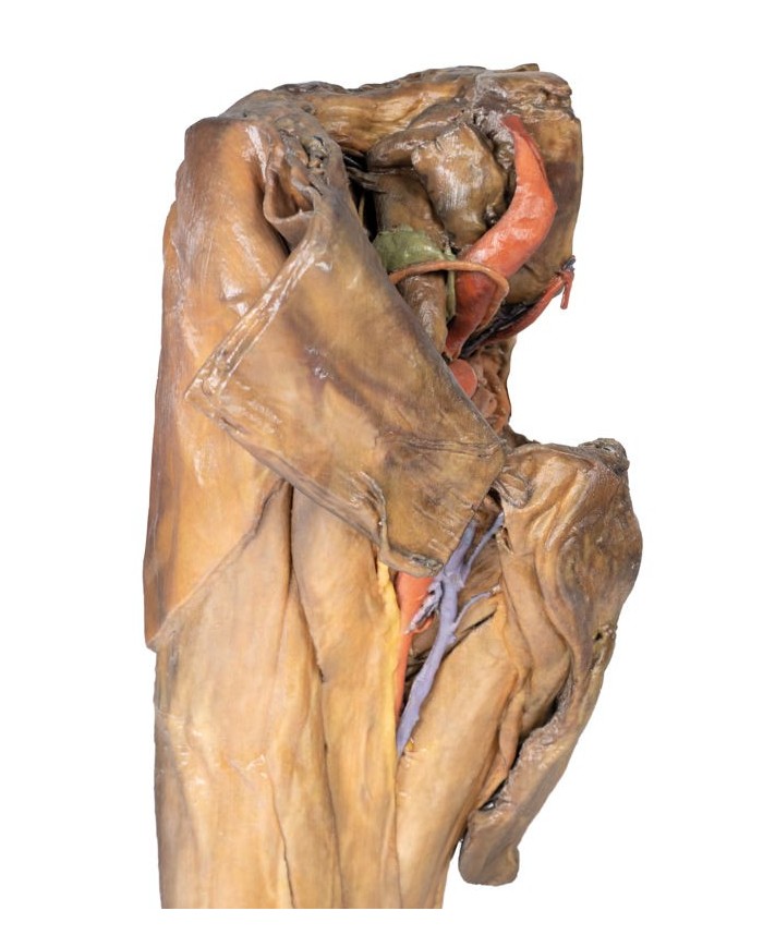 Dissezione di emipelvi e coscia maschile Erler Zimmer 3D anatomy Series M