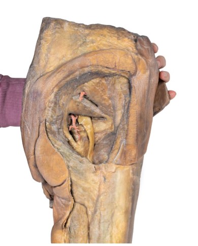 Dissezione di emipelvi e coscia maschile Erler Zimmer 3D anatomy Series M