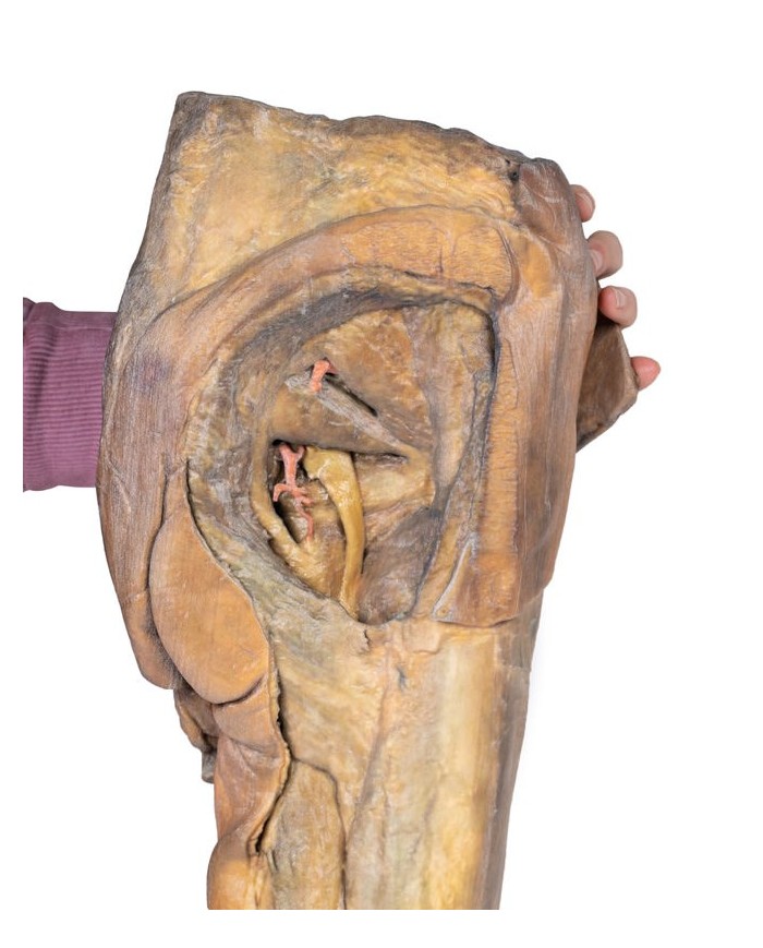 Dissezione di emipelvi e coscia maschile Erler Zimmer 3D anatomy Series M