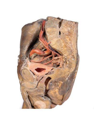 Dissezione di emipelvi e coscia maschile Erler Zimmer 3D anatomy Series M