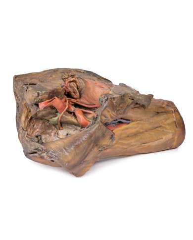 Dissezione di emipelvi e coscia maschile Erler Zimmer 3D anatomy Series M