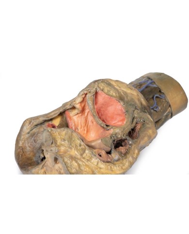 Dissezione di emipelvi e coscia femminile Erler Zimmer 3D anatomy Series 