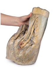 Dissezione di emipelvi e coscia femminile Erler Zimmer 3D anatomy Series 