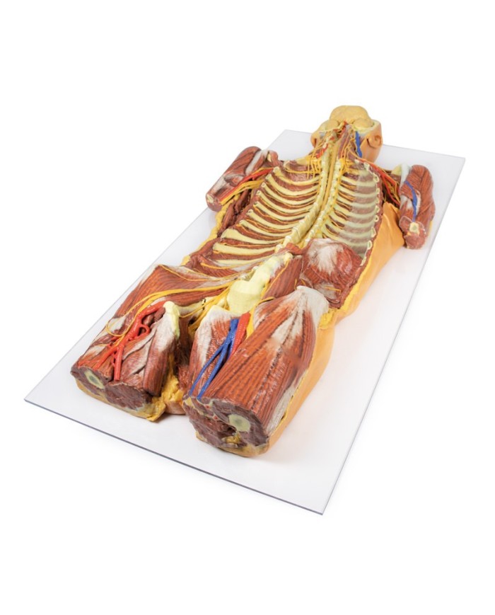 Dissezione profonda ventrale del corpo umano  (Vista posteriore) - Erler Zimmer 3D anatomy Series