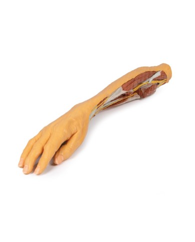 Dissezione superficiale e profonda di avambraccio e mano Erler Zimmer 3D