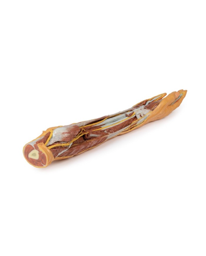 Dissezione superficiale e profonda di avambraccio e mano Erler Zimmer 3D