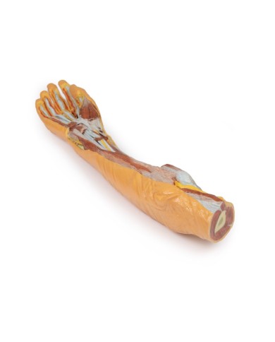 Dissezione superficiale e profonda di avambraccio e mano Erler Zimmer 3D