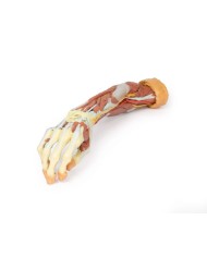 Dissezione profonda dell'arto superiore e della mano - Erler Zimmer 3D anatomy Series
