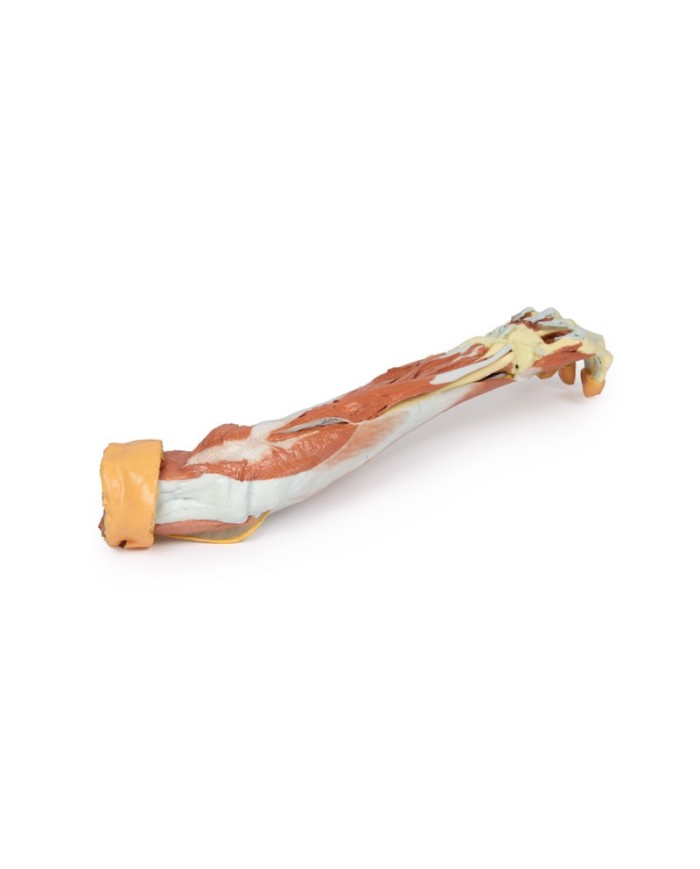 Dissezione profonda dell'arto superiore e della mano - Erler Zimmer 3D anatomy Series