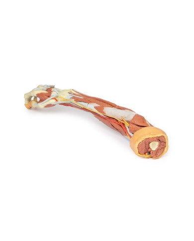 Dissezione profonda dell'arto superiore e della mano - Erler Zimmer 3D anatomy Series