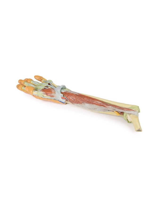 Dissezione profonda dellavambraccio e della mano Erler Zimmer 3D anatomy