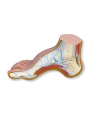 3B Scientific, modello anatomico di Piede cavo (Pes cavus) M32