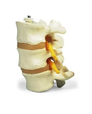 3 vertebre lombari, 3B Scientific, montaggio elastico A76/8