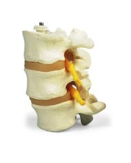 3 vertebre lombari, 3B Scientific, montaggio elastico A76/8