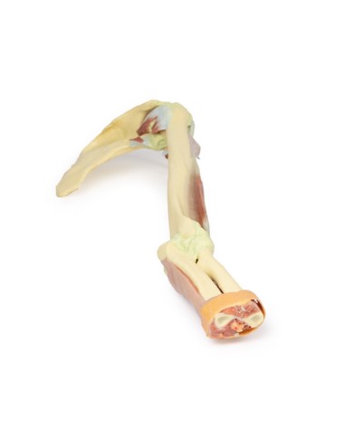 Dissezione dell'arto superiore - Bicipiti, ossa e legamenti - Erler Zimmer 3D anatomy Series