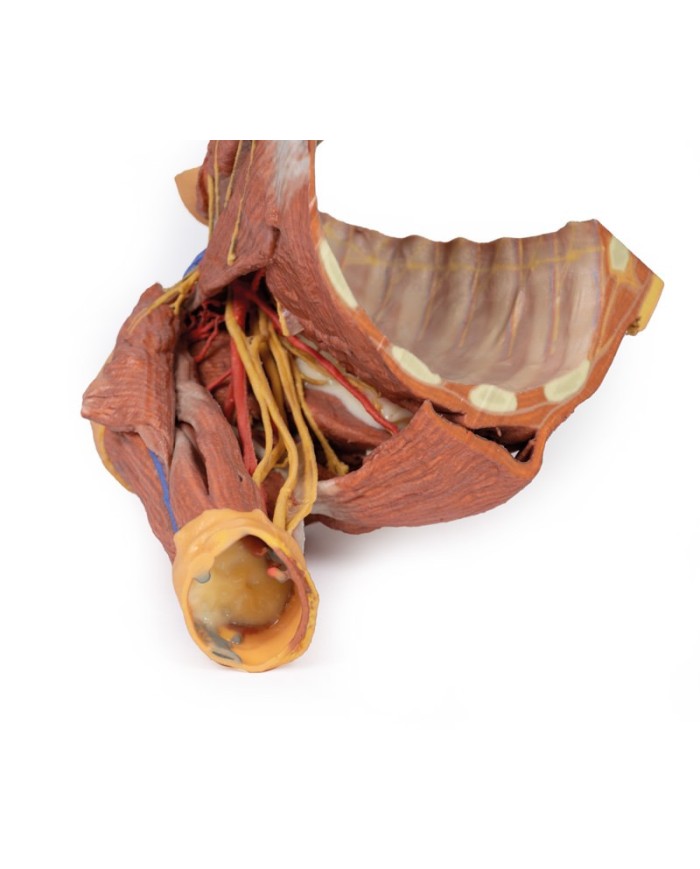 Dissezione della parete toracica destra - ascella e radice del collo - Erler Zimmer 3D anatomy Series