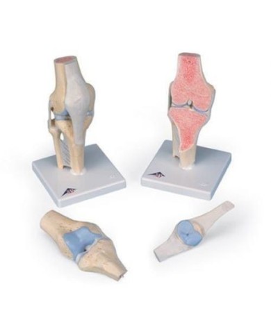 3B Scientific, modello anatomico della sezione articolare del ginocchio, in 3 parti A89