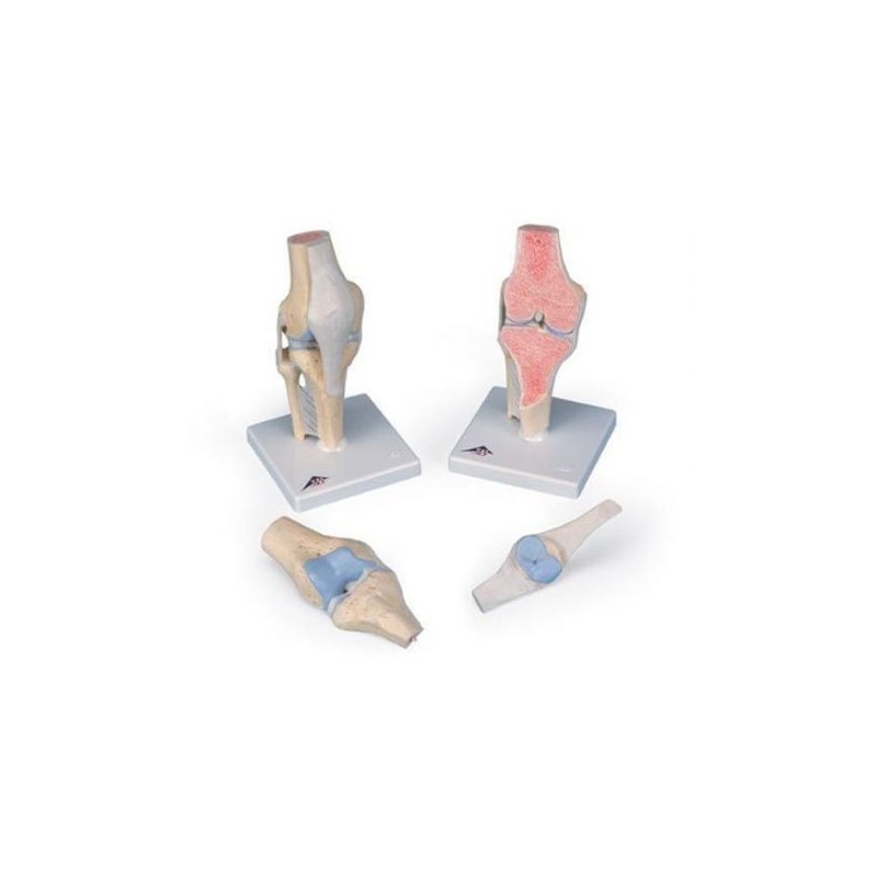 3B Scientific, modello anatomico della sezione articolare del ginocchio, in 3 parti A89