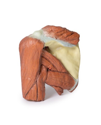 Dissezione della spalla sinistra - Muscoli superficiali e arteria ascellare e brachiale - Erler Zimmer 3D anatomy Series