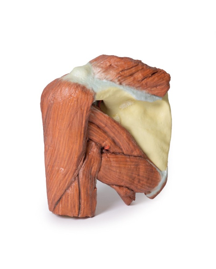 Dissezione della spalla sinistra - Muscoli superficiali e arteria ascellare e brachiale - Erler Zimmer 3D anatomy Series