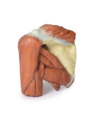 Dissezione della spalla sinistra - Muscoli superficiali e arteria ascellare e brachiale - Erler Zimmer 3D anatomy Series