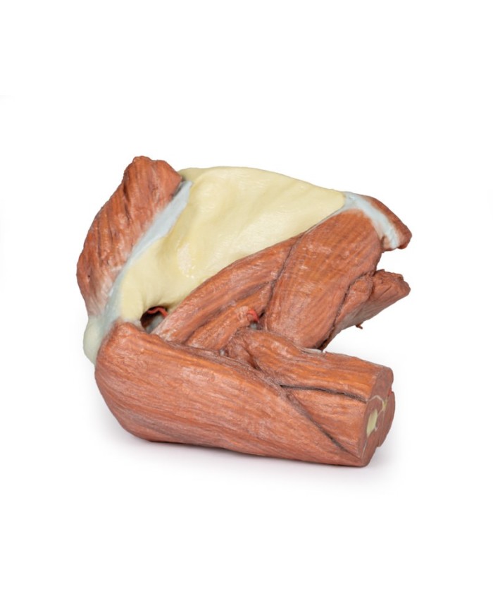 Dissezione della spalla sinistra - Muscoli superficiali e arteria ascellare e brachiale - Erler Zimmer 3D anatomy Series