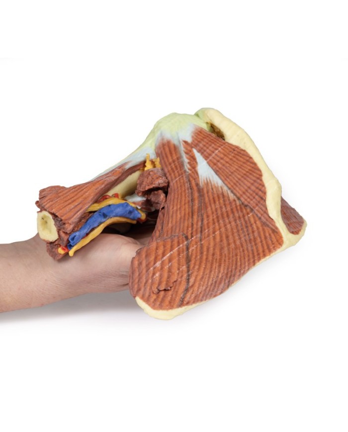 Dissezione profonda della spalla sinistra - Muscolatura, nervi e vasi associati - Erler Zimmer 3D anatomy Series